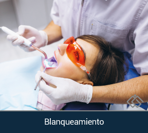 blanqueamiento (1)